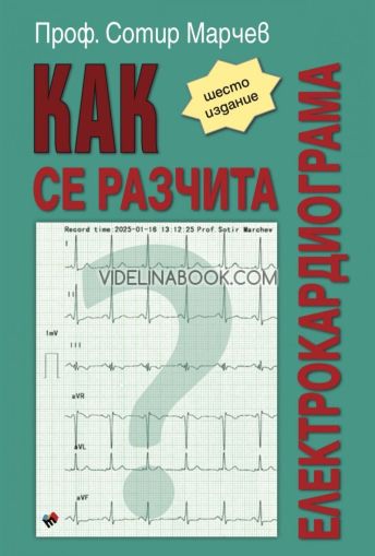 Как се разчита електрокардиограма Проф. Сотир Марчев