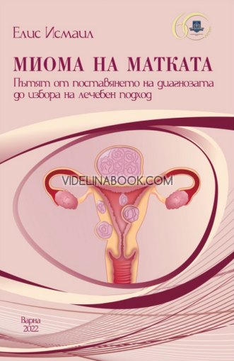 Миома на матката: Пътят от поставянето на диагнозата до избора на лечебен подход, Елис Исмаил 