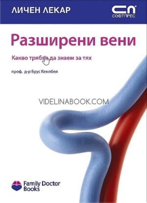 Разширени вени - Какво трябва да знаем за тях, Проф. Брус Кемпбел